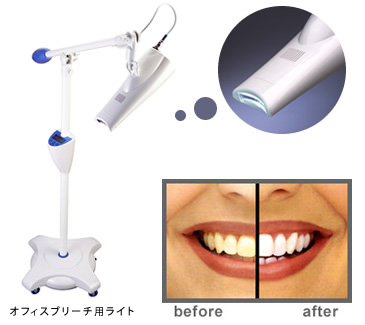 オフィスブリーチ用ライトと使用前・使用後
